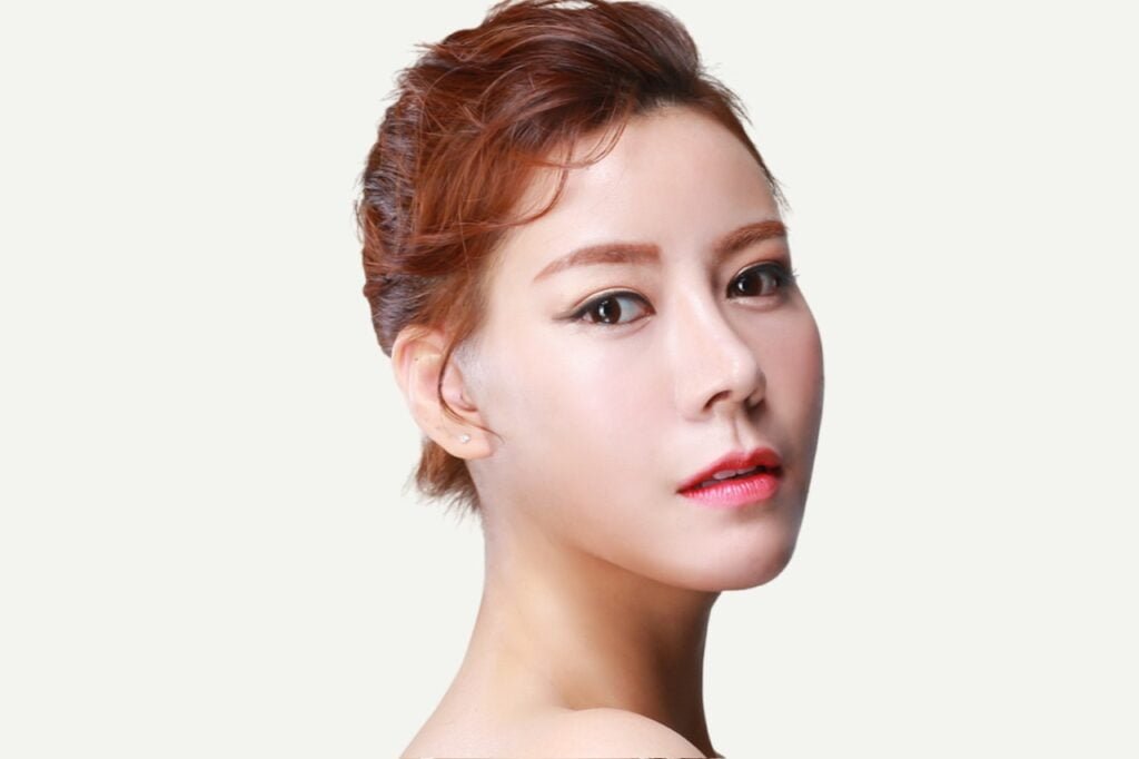 Chemical Peels Korea